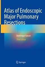 Atlas of Endoscopic Major Pulmonary Resections -  Dominique Gossot