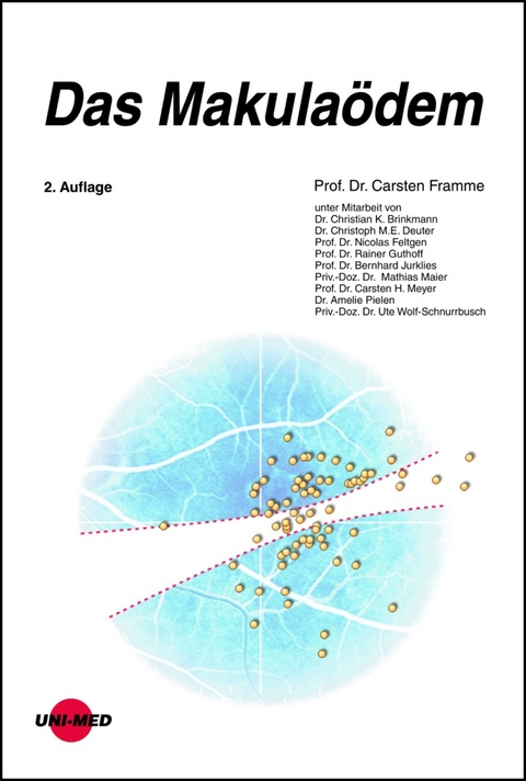 Das Makula&ouml;dem - Carsten Framme