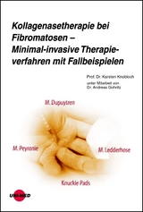 Kollagenasetherapie bei Fibromatosen &ndash; Minimal-invasive Therapieverfahren mit Fallbeispielen - Karsten Knobloch