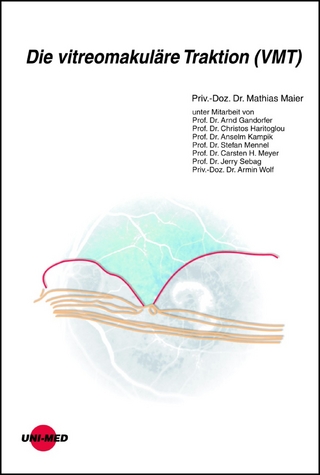 Die vitreomakuläre Traktion (VMT)