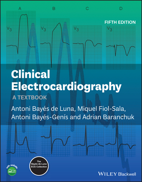 Clinical Electrocardiography - Antoni Bay&eacute;s de Luna, Miquel Fiol-Sala, Antoni Bay&eacute;s-Gen&iacute;s, Adrian Baranchuk