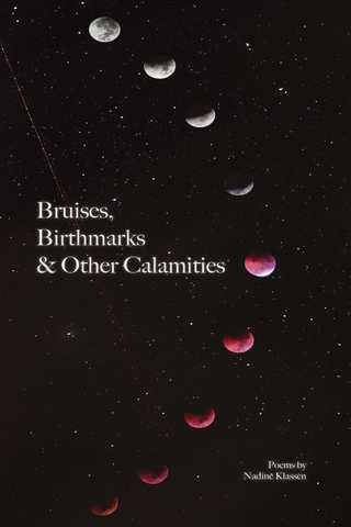 Bruises, Birthmarks & Other Calamities