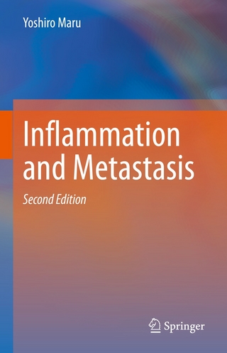 Inflammation and Metastasis