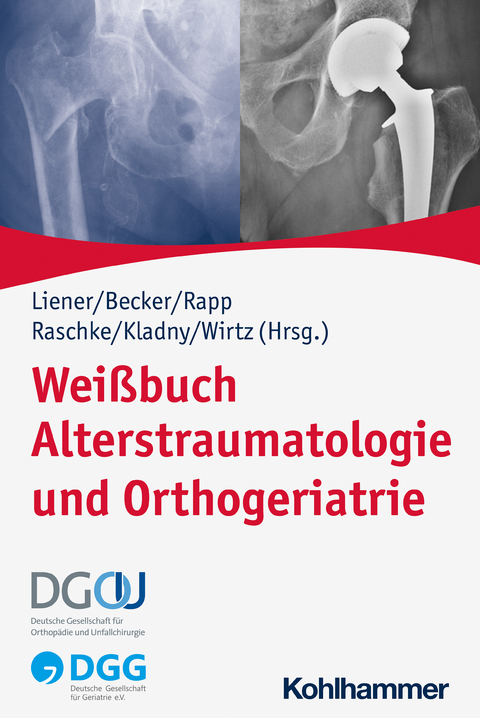 Wei&szlig;buch Alterstraumatologie und Orthogeriatrie - 