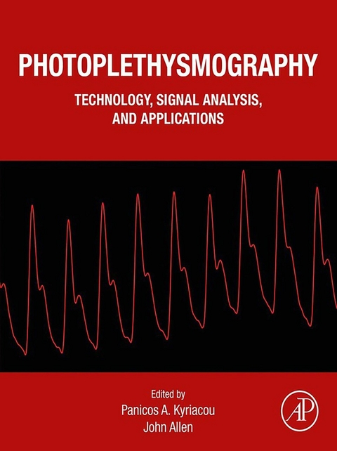 Photoplethysmography - 