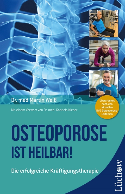 Osteoporose ist heilbar! -  Dr. med. Martin Wei&szlig;