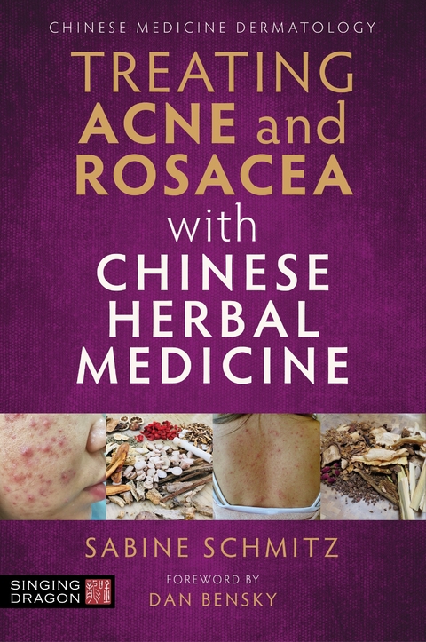 Treating Acne and Rosacea with Chinese Herbal Medicine -  Sabine Schmitz