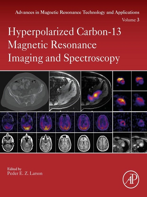 Hyperpolarized Carbon-13 Magnetic Resonance Imaging and Spectroscopy - 