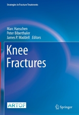 Knee Fractures - 