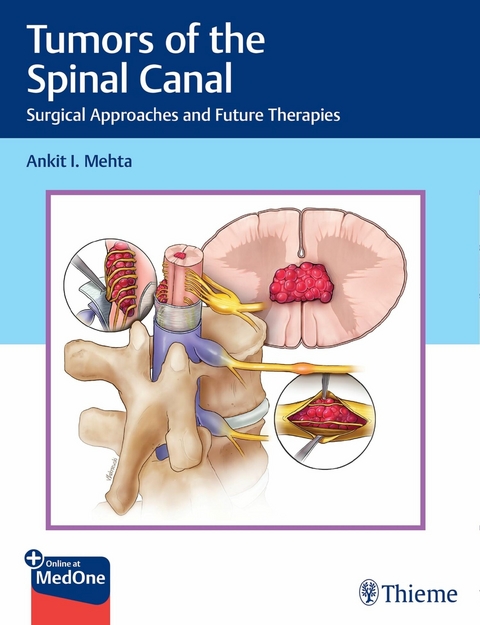 Tumors of the Spinal Canal - Ankit I. Mehta