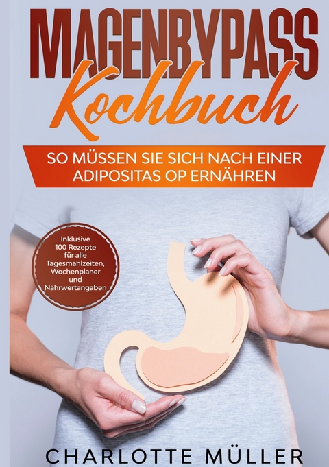 Magenbypass Kochbuch - Charlotte M&uuml;ller