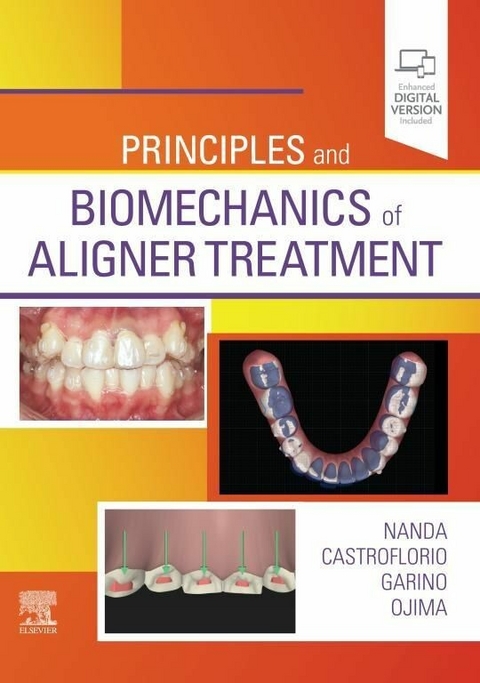 Principles and Biomechanics of Aligner Treatment - E-Book - 