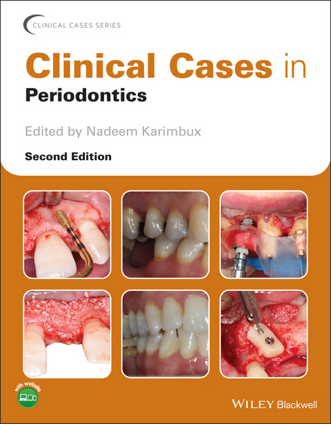 Clinical Cases in Periodontics - 