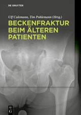 Beckenfraktur beim &auml;lteren Patienten - 