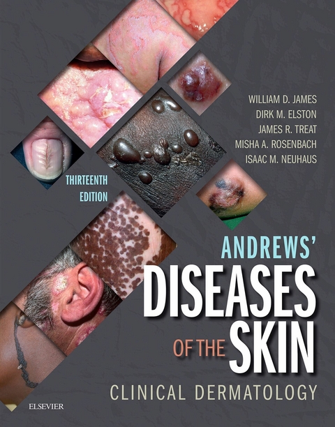 Andrews' Diseases of the Skin -  Dirk M. Elston,  William D. James,  Misha Rosenbach,  James R. Treat