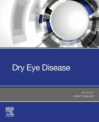 Dry Eye Disease - E-Book