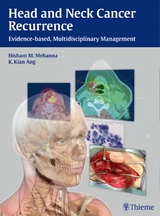 Head and Neck Cancer Recurrence -  Hisham M. Mehanna,  K. Kian Ang