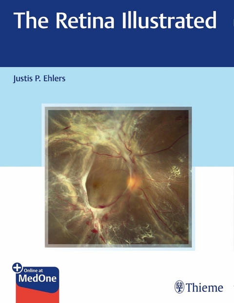 The Retina Illustrated - Justis P. Ehlers