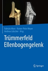 Tr&uuml;mmerfeld Ellenbogengelenk - 