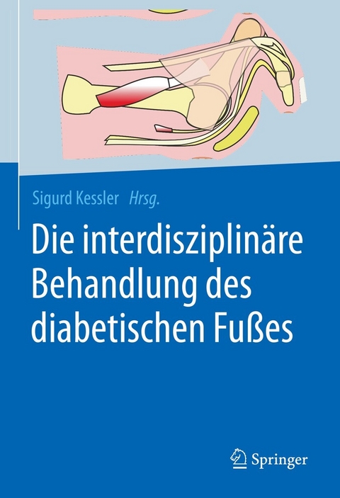 Die interdisziplin&auml;re Behandlung des diabetischen Fu&szlig;es - 