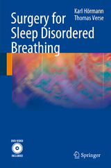 Surgery for Sleep Disordered Breathing - Karl H&ouml;rmann, Thomas Verse