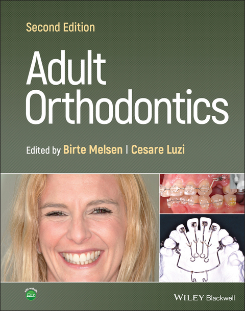 Adult Orthodontics - 