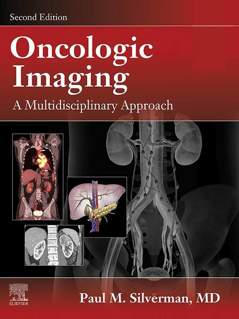 Oncologic Imaging: A Multidisciplinary Approach E-Book - 
