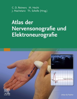 Atlas der Nervensonografie und Elektroneurografie