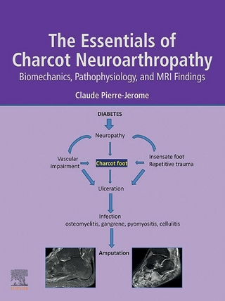 Essentials of Charcot Neuroarthropathy