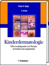 Kinderdermatologie - Peter H H&ouml;ger