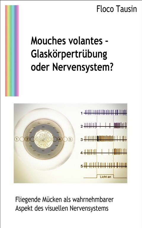 Mouches volantes - Glask&ouml;rpertr&uuml;bung oder Nervensystem? - Floco Tausin