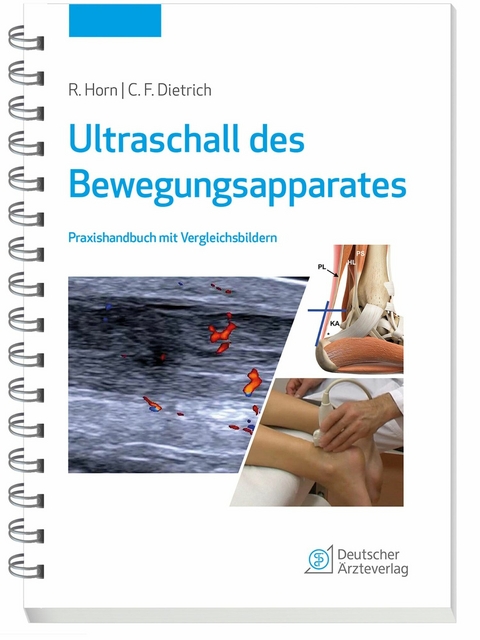 Ultraschall des Bewegungsapparates - Rudolf Horn, Christoph F. Dietrich