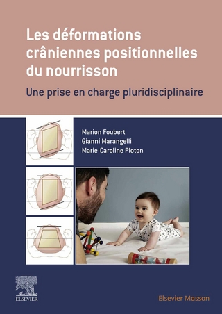 Les déformations crâniennes positionnelles du nourrisson