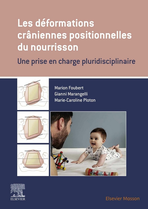 Les d&eacute;formations cr&acirc;niennes positionnelles du nourrisson -  Marion Foubert,  Gianni Marangelli,  Marie-Caroline Ploton