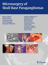 Microsurgery of Skull Base Paragangliomas - Paolo Piazza, Seung-Ho Shin, Sean Flanagan, Mario Sanna, Fernando Mancini