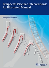 Peripheral Vascular Interventions: An Illustrated Manual - J&uuml;rgen Schr&ouml;der