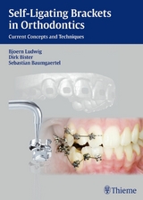 Self-Ligating Brackets in Orthodontics -  Dirk Bister,  Sebastian Baumgaertel,  Bj&ouml;rn Ludwig