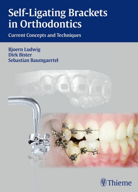 Self-Ligating Brackets in Orthodontics -  Dirk Bister,  Sebastian Baumgaertel,  Bj&ouml;rn Ludwig