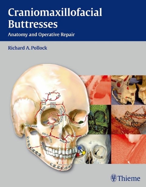 Craniomaxillofacial Buttresses - 