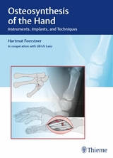 Osteosynthesis of the Hand - Hartmut F&ouml;rstner