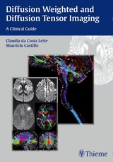 Diffusion Weighted and Diffusion Tensor Imaging - 