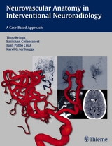 Neurovascular Anatomy in Interventional Neuroradiology - Timo Krings, Sasikhan Geibprasert, Karel ter Brugge, Juan Pablo Cruz