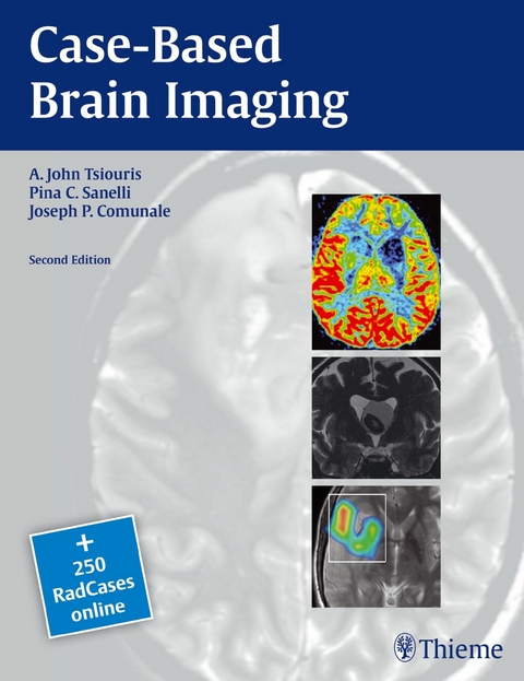 Case-Based Brain Imaging -  A. John Tsiouris,  Pina C. Sanelli,  Joseph Comunale