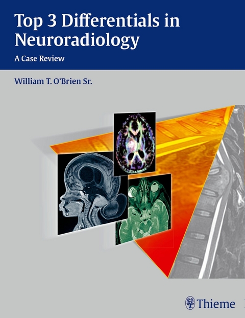 Top 3 Differentials in Neuroradiology -  William T. O'Brien