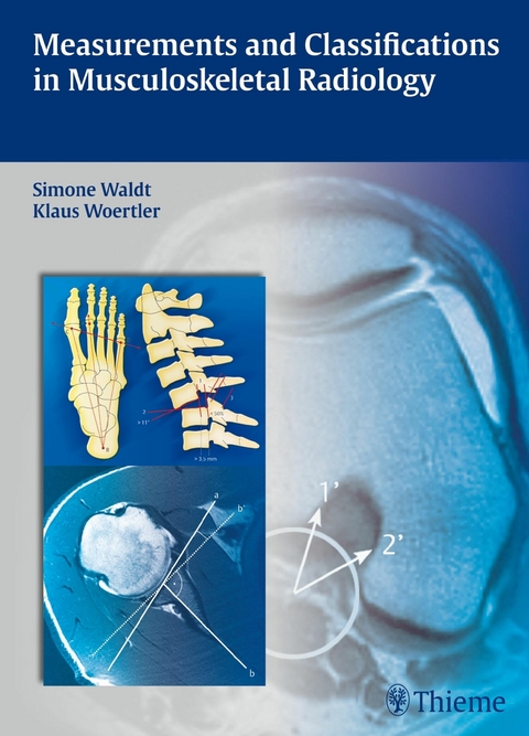 Measurements and Classifications in Musculoskeletal Radiology - Simone Waldt, Klaus W&ouml;rtler