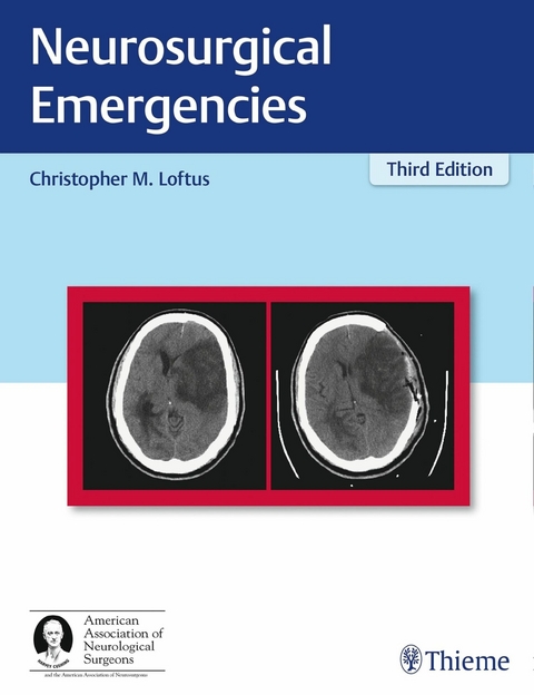 Neurosurgical Emergencies - 