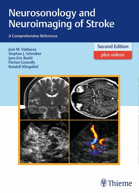 Neurosonology and Neuroimaging of Stroke - Jos&eacute; Manuel Valdueza, Stephan Schreiber, Jens-Eric R&ouml;hl, Florian Connolly, Randolf Klingebiel