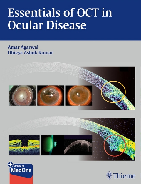 Essentials of OCT in Ocular Disease - 