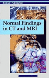Normal Findings in CT and MRI - Torsten Bert Moeller, Emil Reif