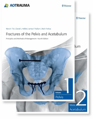 Fractures of the Pelvis and Acetabulum